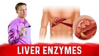 High Liver Enzymes ALT amp AST – What Do They Mean – DrBerg [upl. by Htennaj516]