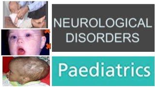 4 Neurological Disorders Paediatrics  Pyogenic Meningitis Management  UQs [upl. by Nael]