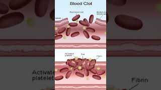 platelets kam hone se kya hota hai short video [upl. by Ellison]