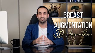 Breast Augmentation Animation  Op Dr Burak Pasinlioğlu [upl. by Benedicta]