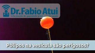 Pólipos na vesícula são perigosos Por Dr Fabio Atui 02122015 [upl. by Enrica]