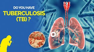 What is Tuberculosis TB Symptoms Causes Diagnosis and Treatment [upl. by Umberto860]