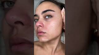 My 6 week retinol skin transformation 🫢 i cant believe it Glow Recipe blackberry retinol serum [upl. by Ahen]