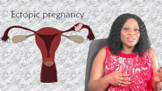 Ectopic Pregnancy  Implantation Bleeding  Implantation Process [upl. by Aicen]