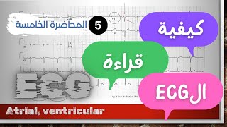 المحاضرة الخامسة  ventricular tachycardia  ventricular fibrillation  torsades  AF  flutter [upl. by Agostino]