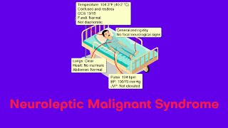 Neuroleptic Malignant Syndrome  NMS  Hyperpyrexia syndromes [upl. by Erving]