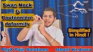 Learn Rheumatoid arthritis deformities Swan neck amp boutonnierein just 4 minutes in hindi Ishant [upl. by Ahsenor702]