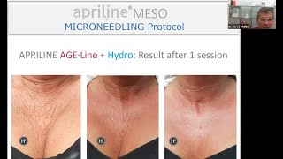 Apriline® webinar  Led by Dr Hervé Padey Recording of the 18th of June [upl. by Hertzog]