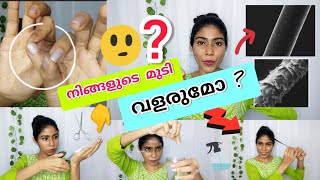 🌸മുടിയിൽ ഇനി ഒന്നും ചെയ്യാൻ ബാക്കി ഇല്ലേ Know your Hair [upl. by Jobina]