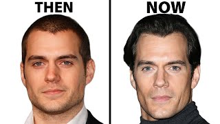 Is Henry Cavills Face All Natural  Plastic Surgery Analysis [upl. by Saudra]