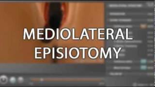 Trailer  Chapter on Episiotomy [upl. by Assillim]