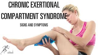 What are the symptoms of chronic exertional compartment syndrome CECS [upl. by Avis]