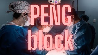 Podcast PENG Block  Pericapsular Nerve Group Block  2024 [upl. by Helbonia]