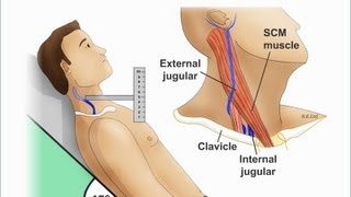 Jugular Venous Distention Explained clearly PART A Jugular venous pressure Waveform [upl. by Nylaroc963]