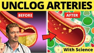 Top Foods to Clean Arteries amp Prevent Heart Attack Sarcasm Alert [upl. by Davine]