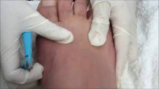 pedicura para hombres paso a paso [upl. by Yecac593]