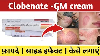 Clobenate gm cream ke fayde  Clobenate gm cream kis kaam aati hai  Clobenate gm cream uses [upl. by Staford293]