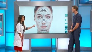 What Your Acne Says about Your Health [upl. by Sirrom189]