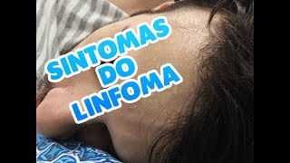 SINTOMAS DO LINFOMA [upl. by Onia]