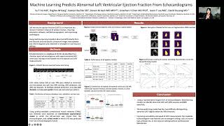 Ejection Fraction by 2D method [upl. by Aissela]