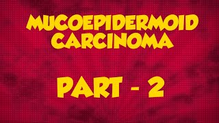 MUCOEPIDERMOID CARCINOMA  PART 2  SALIVARY GLAND TUMORS [upl. by Adeuga]