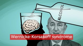 مرض تبون  WernickeKorsakoff syndrome [upl. by Einnod]