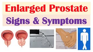 Enlarged Prostate Signs amp Symptoms amp Why They Occur [upl. by Roda472]