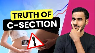 Truth Of C Section Rise In India  Caesarean Delivery  Kishan Shou [upl. by Macegan]