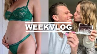 BUIK UPDATE 20 WEKEN ZWANGER amp ZWANGERSCHAPS QampA  Weekvlog✨ [upl. by Dehsar]