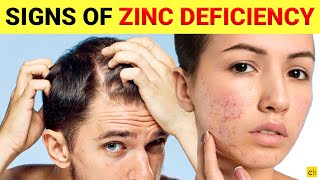 Do you know these 7 Shocking signs of Zinc Deficiency  Credihealth [upl. by Rebe]