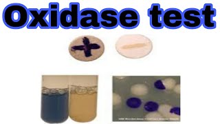 Oxidases test biochemical test lecture 2 [upl. by Kannav100]