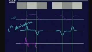 Lecture  29 Image Segmentation  I [upl. by Reeve]