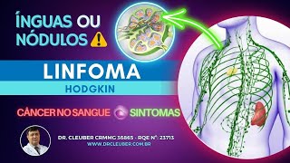 🟢 Linfoma de Hodgkin O que é ⚠️ Cuidado com Ínguas e Caroços [upl. by Beaumont944]