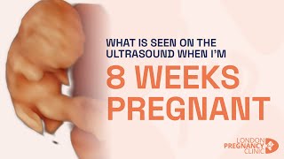 8 Weeks Pregnant First Movements via 4D Ultrasound Scan [upl. by Polito710]