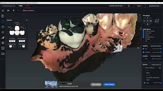 Glidewell Fastmill io Crown design 3 restoration site copy biocopy [upl. by Feltie]