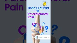 Hoffa’s Fat Pad vs Patellofemoral Pain physicaltherapy physiotheraphy kneepain [upl. by Adyam]