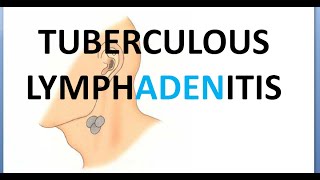 Surgery 027 Tubercular Lymphadenitis tuberculous tuberculosis stage cold abscess IRIS [upl. by Javed878]