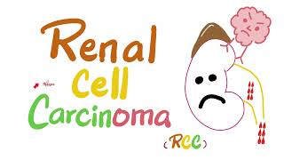 Renal Cell Carcinoma RCC  Kidney Tumors  Neoplasms  Renal Pathology  Nephrology [upl. by Nylirret]