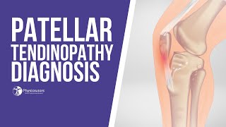 How to Diagnose Patellar Tendinopathy  Jumpers Knee Diagnosis [upl. by Asirap]