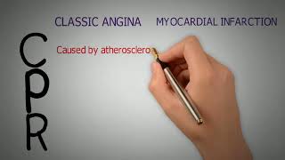 Classic Angina vs Myocardial Infarction  Be heart smart in less than 3 min  PharmCept [upl. by Posner]