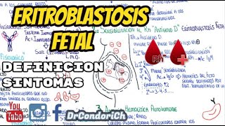 Eritroblastosis Fetal Incompatibilidad Rh ¿Que es¿como sospechar [upl. by Culhert134]