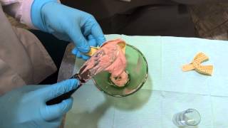 Taking an Awesome Alginate Impression [upl. by Ellevel]