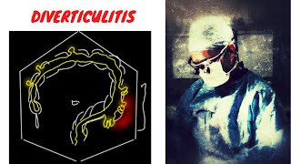 DIVERTICULITIS EXPLAINED [upl. by Corvin]