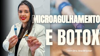 COMO FAZER MICROAGULHAMENTO COM BOTOX  Técnicas associadas [upl. by Bor601]