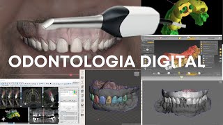 Vantagens da Odontologia Digital [upl. by Kessel]