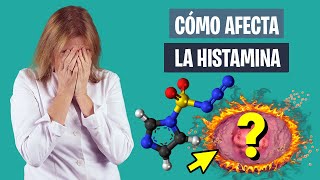 INTOLERANCIA a la HISTAMINA y su EFECT0 en el DEPORTE  Alergia al deporte  Nutrición deportiva [upl. by Ahsilahk]