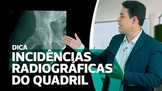 INCIDÊNCIAS RADIOGRÁFICAS BÁSICAS QUADRIL  Dica Ammo [upl. by Downing]