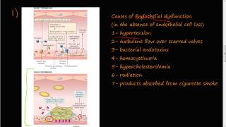 53  Thrombosis Virchows triad Endothelial Injury [upl. by Noscire]