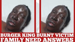 Family Quarrel Over Burger King Burnt Victim money to Pay Air Ambulance [upl. by Levitt]