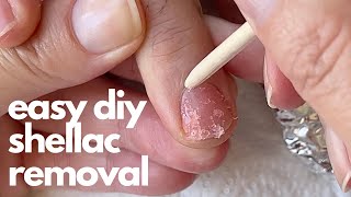 How to remove shellac at home Pro Nail Tech explains in detail [upl. by Yrem850]